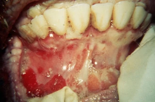 Fièvre aphteuse : les premières restrictions
